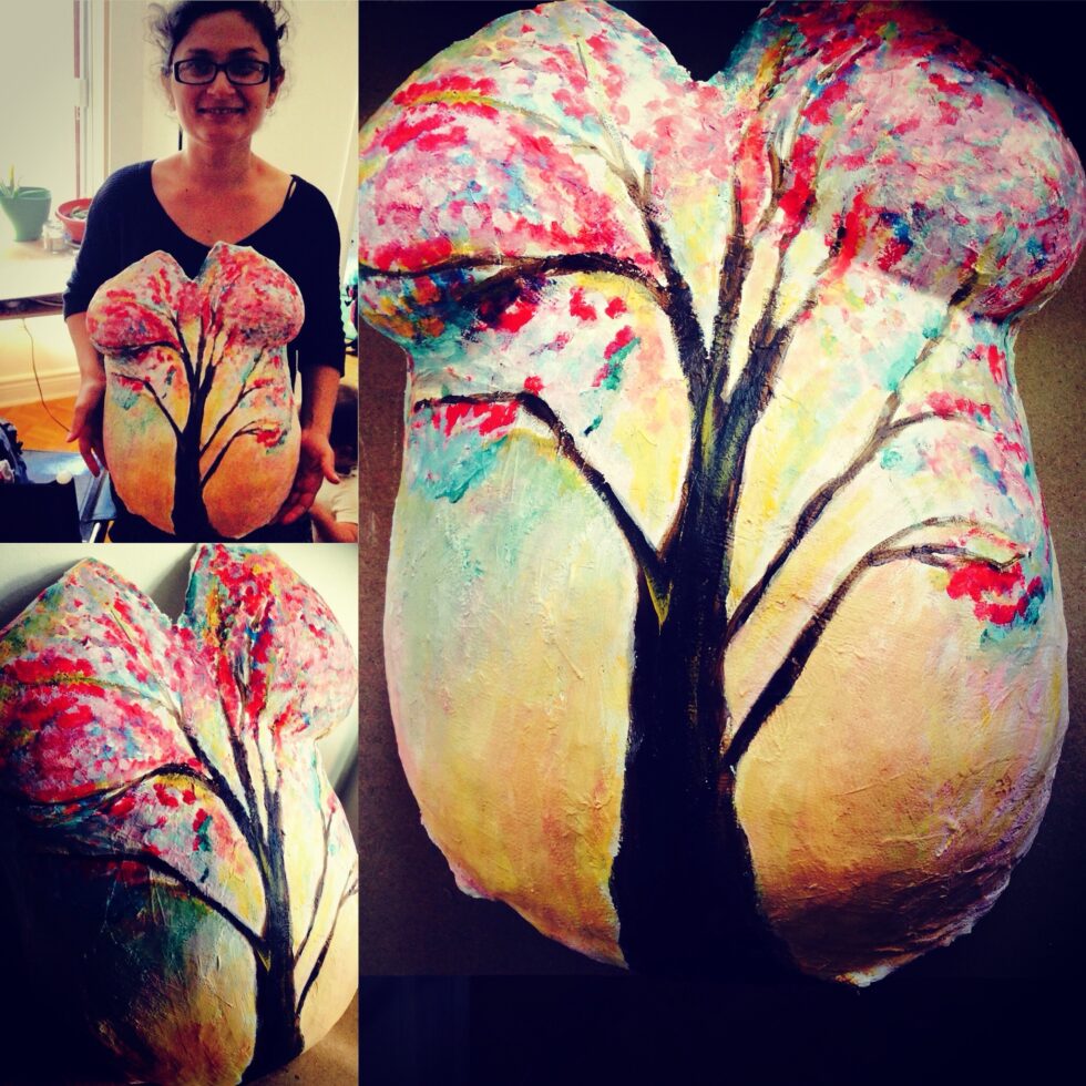 έργο σε γύψο